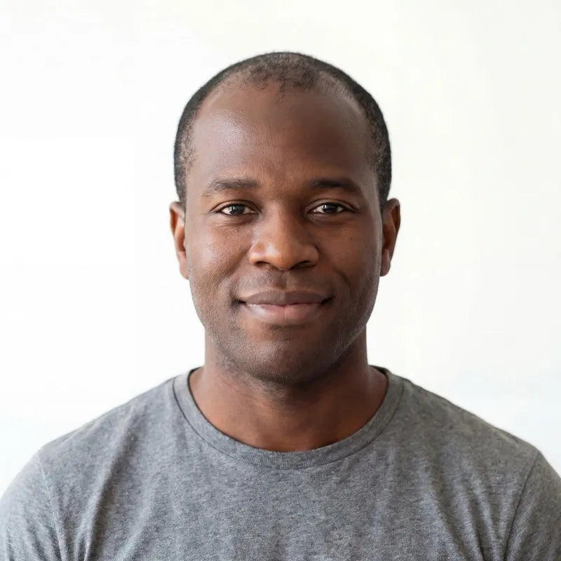 Before hair regrowth results - Alex K., 5 MONTHS