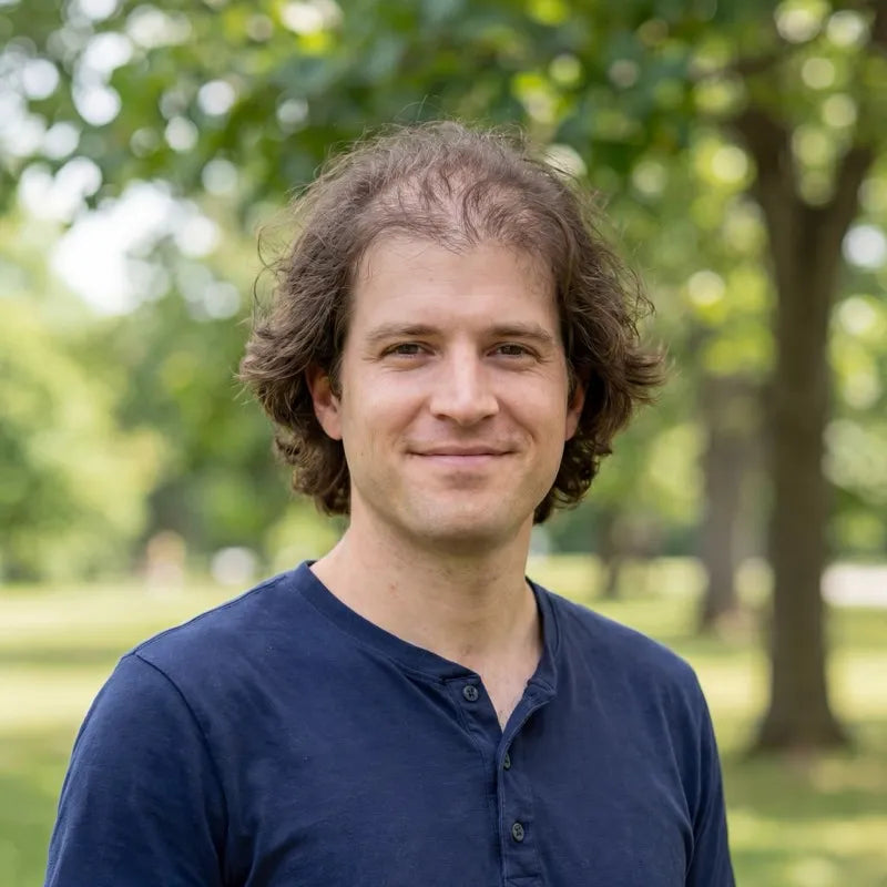 Before hair regrowth results - Chris P., 4 MONTHS