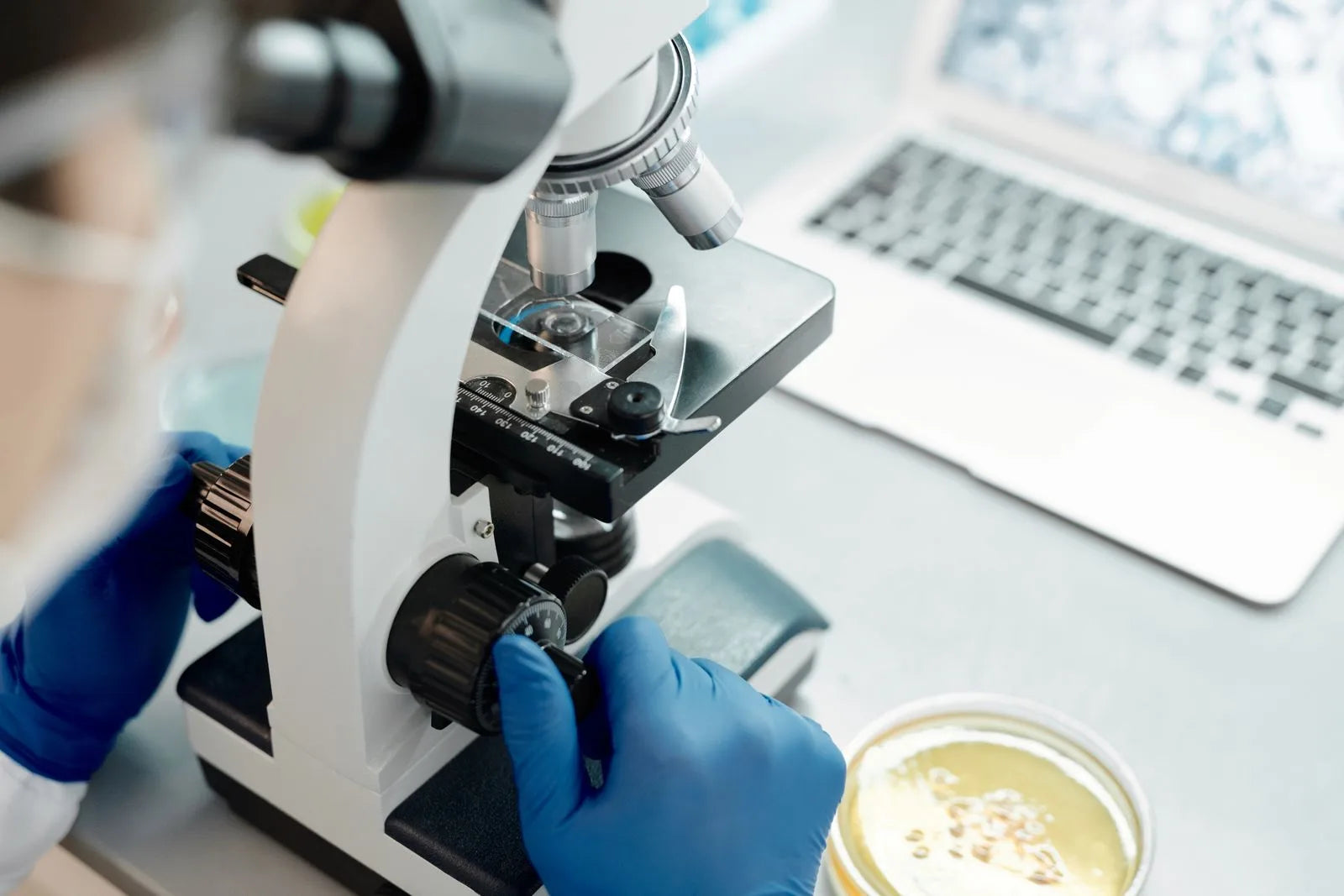 Researcher closely examining biological samples under a laboratory microscope, representing the emerging scientific study of exosome therapy for hair growth