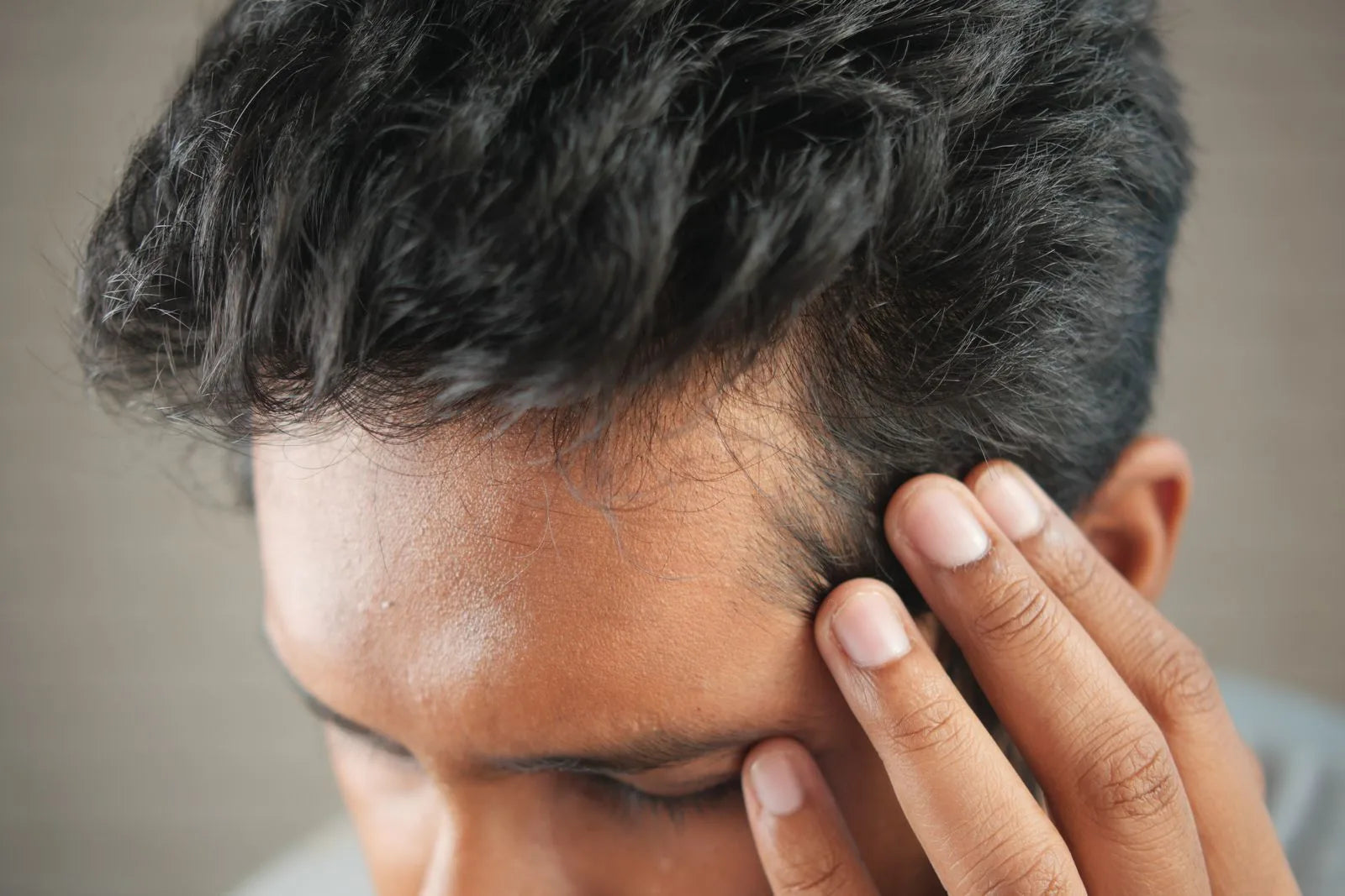Close-up of a man examining his receding hairline with his fingers, checking for thinning hair at the temple