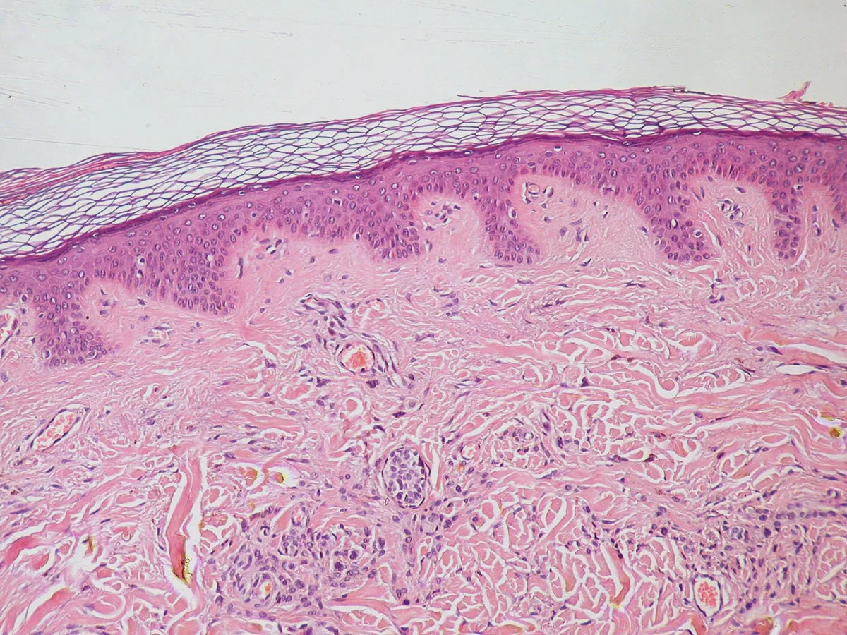 Prostaglandins and Hair Growth: PGD2, PGE2, and Follicle Signaling