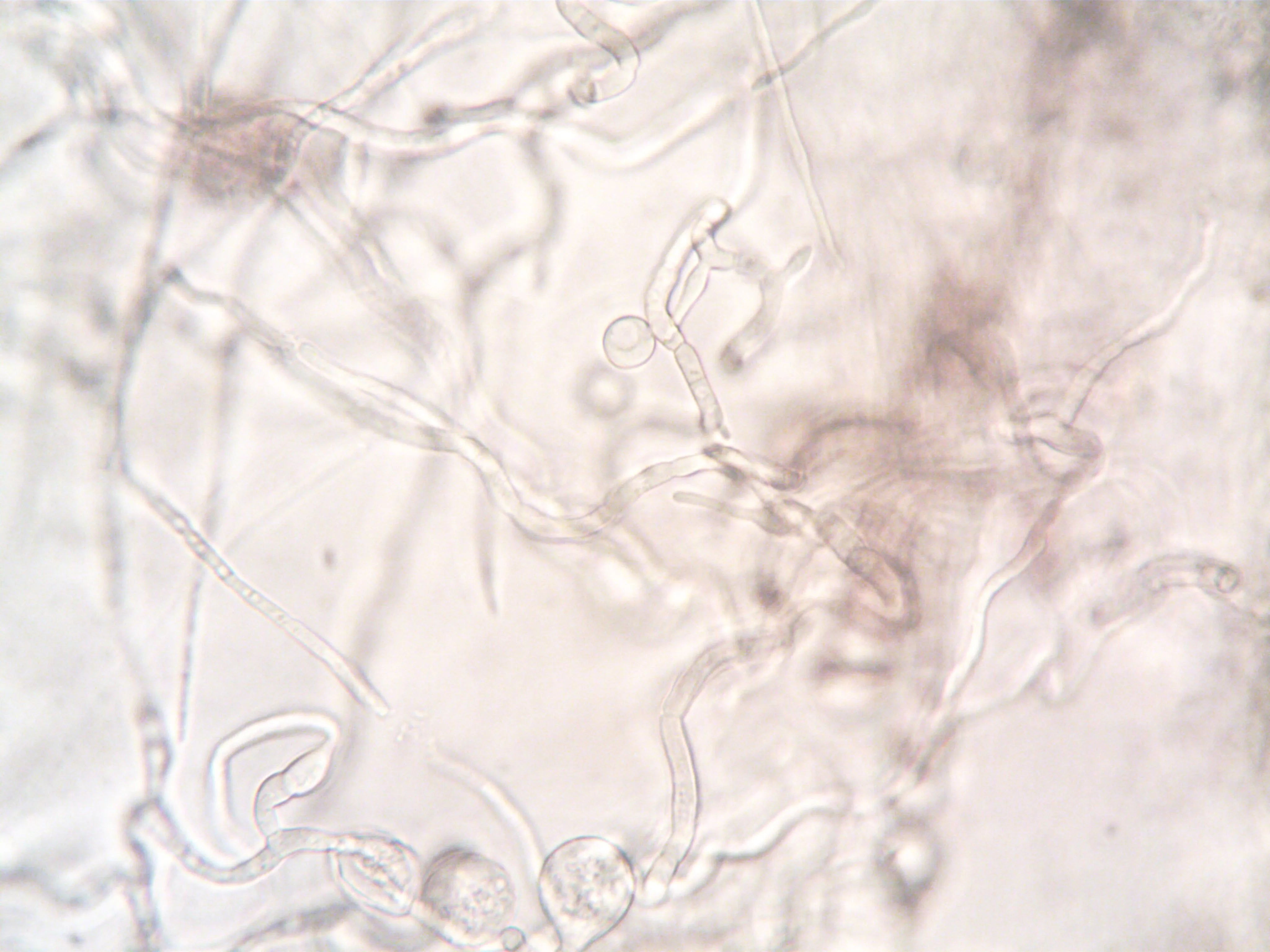 The Scalp Microbiome: How Bacteria and Fungi Affect Hair Growth