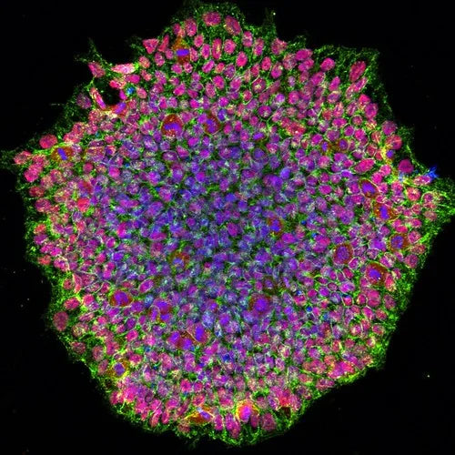 Stem Cells and Hair Regeneration: Current Research and Future Promise