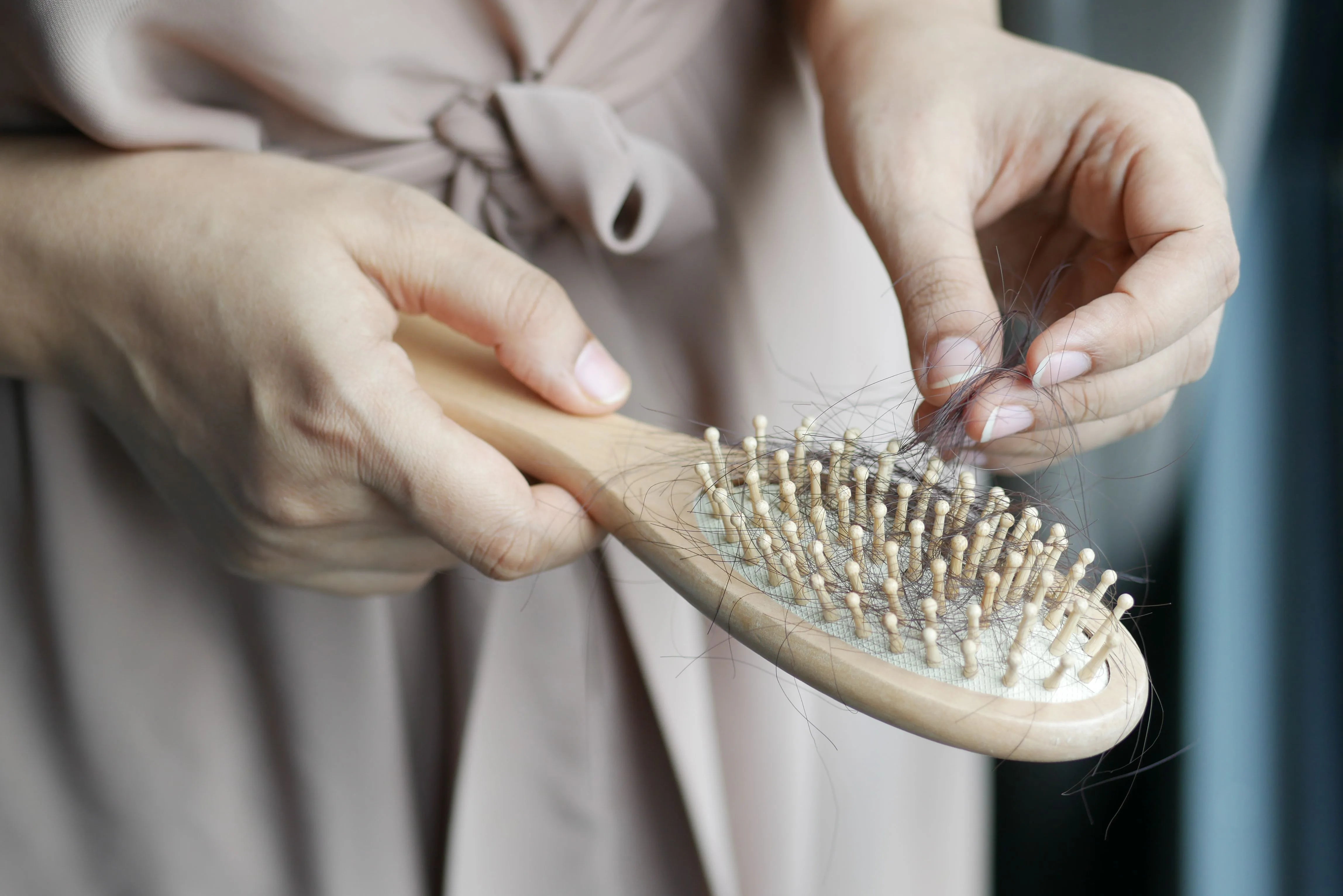 Telogen Effluvium vs. Androgenic Alopecia